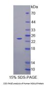 Human NCALd Protein