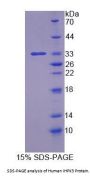Human IHPK3 Protein