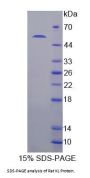 Rat Klotho (KL) Protein