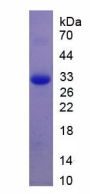 Brain Derived Neurotrophic Factor (BDNF) Protein