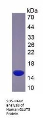 Human Solute Carrier Family 2, Facilitated Glucose Transporter Member 3 (SLC2A3) Protein