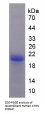Human Attractin (ATRN) Protein