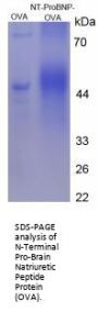 Rat N-Terminal Pro-Brain Natriuretic Peptide (NT-ProBNP) Peptide (OVA)