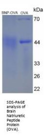 Human Brain Natriuretic Peptide (BNP) Peptide (OVA)