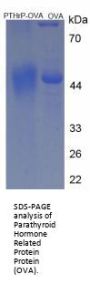 Human Parathyroid Hormone-Related Protein / PTHrP (PTHLH) Peptide (OVA)