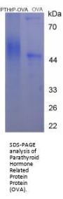 Rat Parathyroid Hormone-Related Protein / PTHrP (PTHLH) Peptide (OVA)