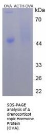 Human Adrenocorticotropic Hormone (ACTH) Peptide (OVA)