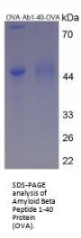 Mouse Amyloid Beta Peptide 1-40 (Ab1-40) Peptide (OVA)