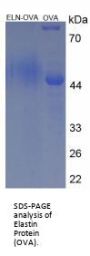 Human Alpha-2-Macroglobulin (A2M) Peptide (OVA)