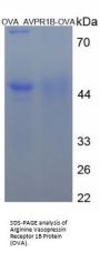 Human Arginine Vasopressin Receptor 1B (AVPR1B) Peptide (OVA)