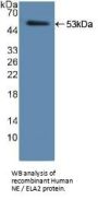 Human Neutrophil Elastase / ELA2 (ELANE) Protein (Active)