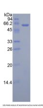 Human Adiponectin Receptor 1 (ADIPOR1) Protein (Active)