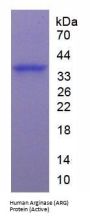 Human Arginase (ARG) Protein (Active)