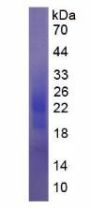 Human Colony Stimulating Factor 2, Granulocyte Macrophage (GMCSF) Protein (Active)