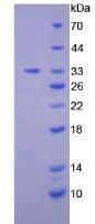 Human Diacylglycerol Kinase Epsilon (DGKe) Protein (Active)