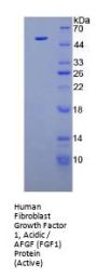 Human Fibroblast Growth Factor 1, Acidic / AFGF (FGF1) Protein (Active)