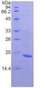 Human Fibronectin Type III Domain Containing Protein 5 (FNDC5) Protein (Active)