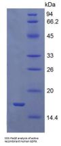 Human Growth Differentiation Factor 9 (GDF9) Protein (Active)