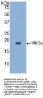 Human Growth Differentiation Factor 9 (GDF9) Protein (Active)