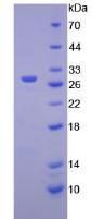 Mouse Hexosaminidase A Alpha (HEXa) Protein (Active)