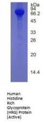 Human Histidine Rich Glycoprotein (HRG) Protein (Active)