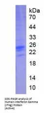 Human Interferon Gamma (IFNg) Protein (Active)
