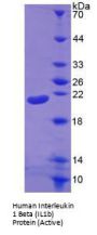 Human Interleukin 1 Beta (IL1b) Protein (Active)