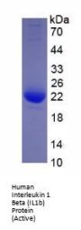 Human Interleukin 1 Beta (IL1b) Protein (Active)
