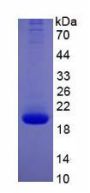 Human Interleukin 10 (IL10) Protein (Active)