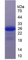 Human Interleukin 17 Receptor C (IL17RC) Protein (Active)