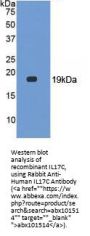 Human Interleukin 17C (IL17C) Protein (Active)