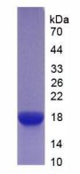 Mouse Interleukin 6 Receptor (IL6R) Protein (Active)
