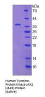 Human Tyrosine-Protein Kinase JAK2 (JAK2) Protein (Active)