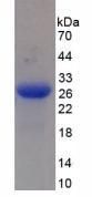 Human Mannose Associated Serine Protease 2 (MASP2) Protein (Active)