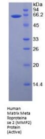 Human Matrix Metalloproteinase 2 (MMP2) Protein (Active)