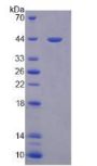 Human Paraoxonase 3 (PON3) Protein (Active)