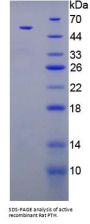 Rat Parathyroid Hormone (PTH) Protein (Active)