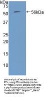 Rat Parathyroid Hormone (PTH) Protein (Active)