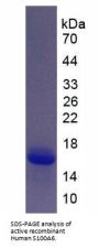 Human S100 Calcium Binding Protein A6 (S100A6) Protein (Active)