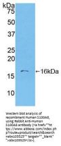 Human S100 Calcium Binding Protein A6 (S100A6) Protein (Active)