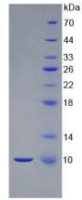 Mouse S100 Calcium Binding Protein B (S100B) Protein (Active)
