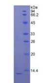 Rat S100 Calcium Binding Protein B (S100B) Protein (Active)