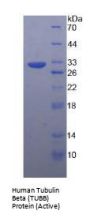 Human Tubulin Beta (TUBB) Protein (Active)