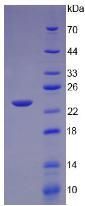 Human Lymphotoxin Alpha (LTA) Protein (Active)