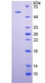 Human Tumor Necrosis Factor Receptor Superfamily Member 10B / DR5 (TNFRSF10B) Protein (Active)