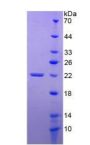 Human Tumor Necrosis Factor Receptor Superfamily, Member 14 (TNFRSF14) Protein (Active)