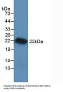 Rat Vascular Endothelial Growth Factor A (VEGFA) Protein (Active)
