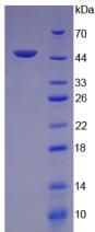 Human Vascular Endothelial Growth Factor C (VEGFC) Protein (Active)