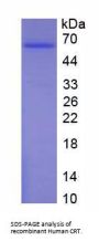 Human Calreticulin (CALR) Protein