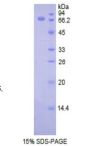 Rat Hyaluronan Synthase 1 (HAS1) Protein